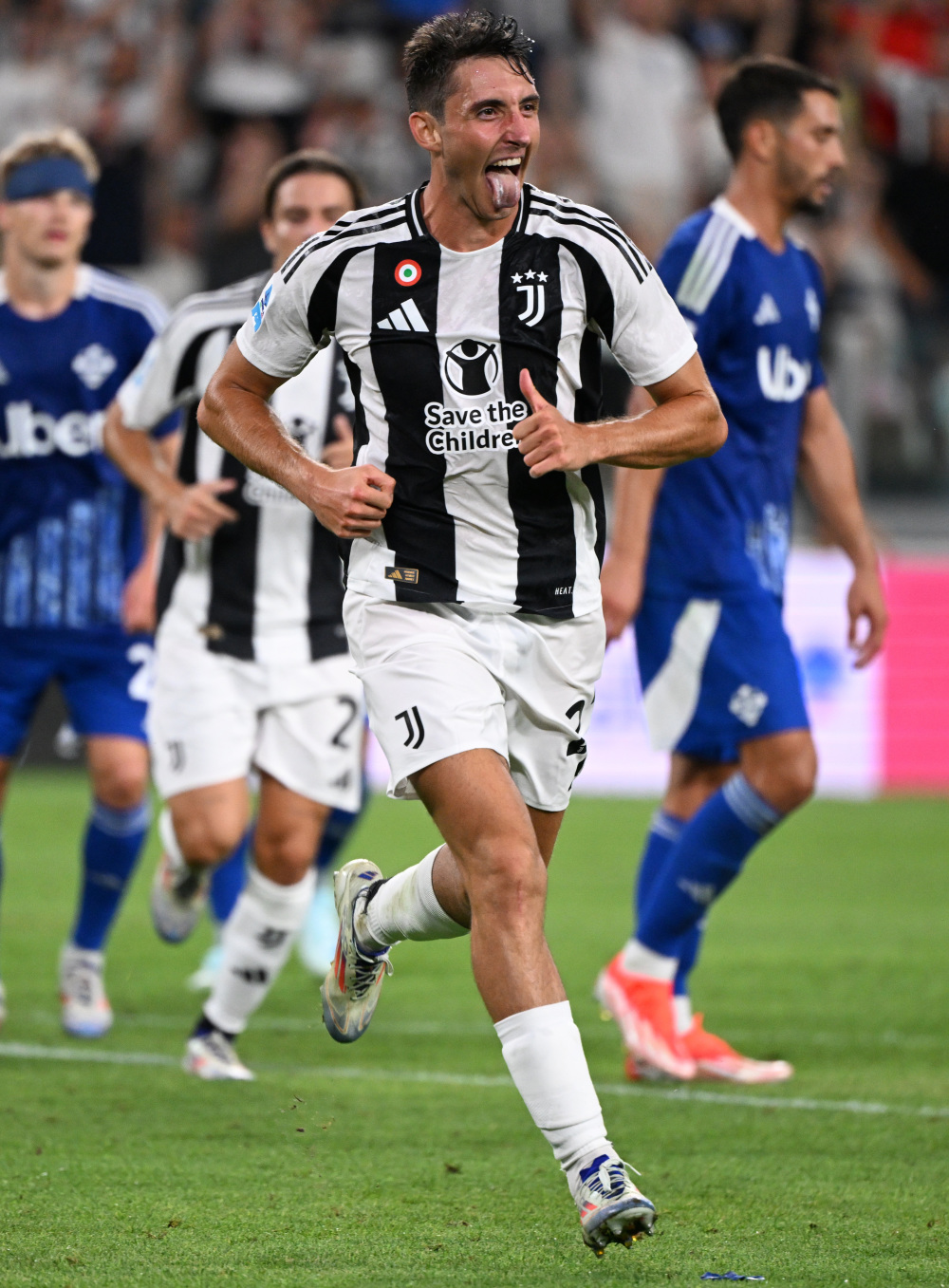 日媒：日本国门铃木彩艳预计13日在日本接受手指骨折手术（日媒：日本队门将铃木彩艳预计13日在本土接受手指骨折手术）